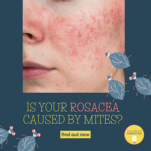 Is Your Rosacea Caused By Mites Demodex Mites