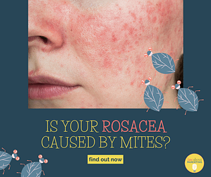 Is Your Rosacea caused by mites
